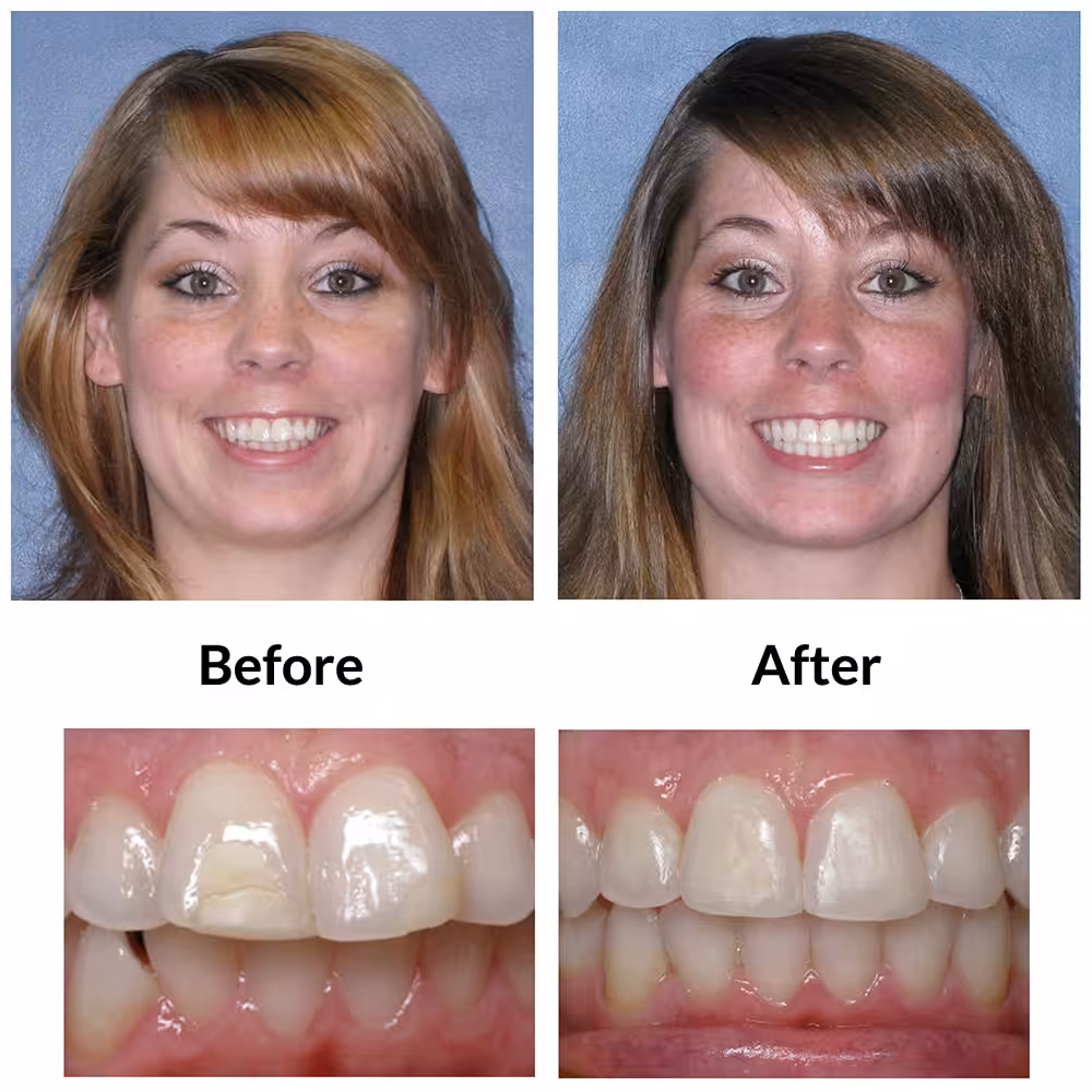 Adult2 Before Final Photo