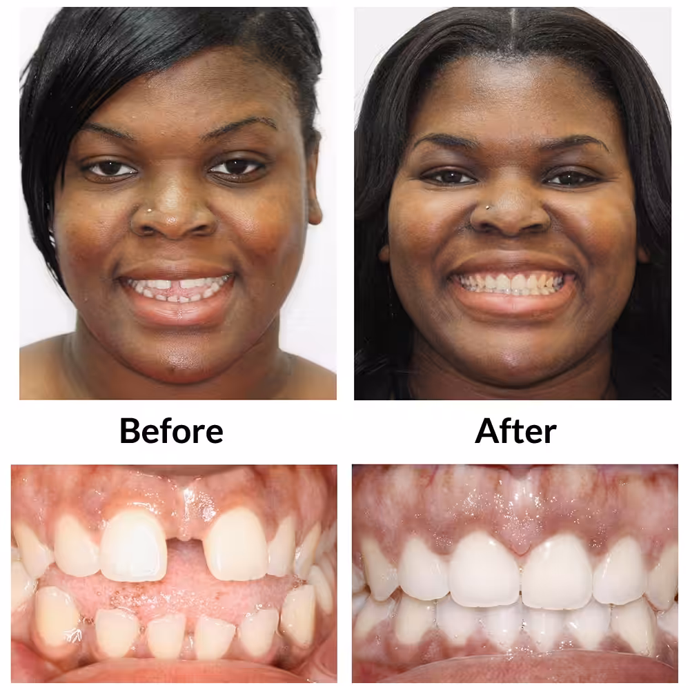 Adult3 Before Final Photo