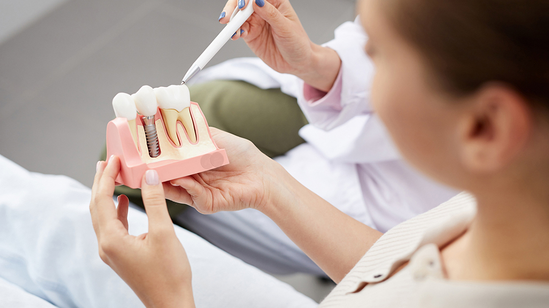 Dental implant
